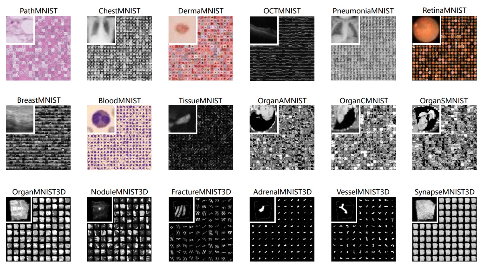 Medical Image Classification with DL