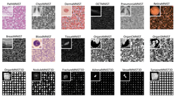 Medical Image Classification with DL